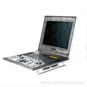 Children kidney stones ultrasound diagnostic instrument